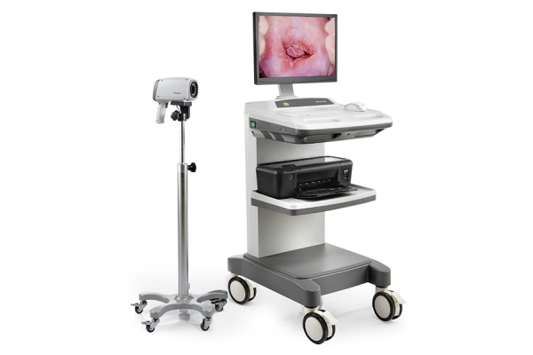 C6 Video Colposcope