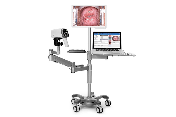 C6A Video Colposcope